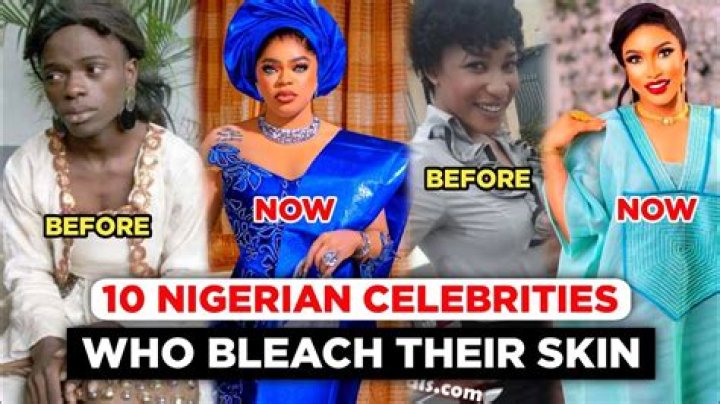 Did Zari Bleach Her Skin?