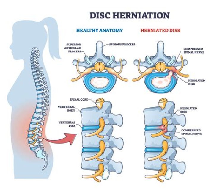 Unlocking The Secrets Of Spinal Cord Injury